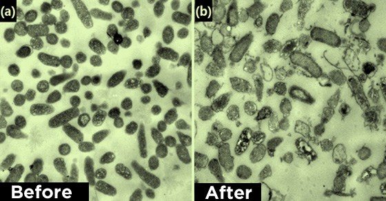 תאים סרטניים - לפני ואחרי חודש טיפול בשמן קנאביס