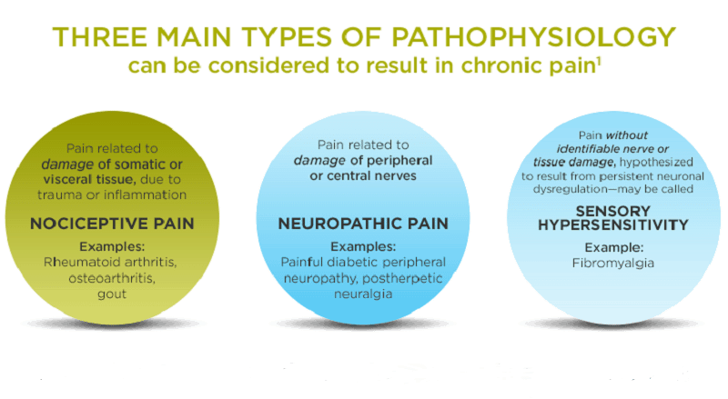 שלושה סוגים עיקריים של כאב - אבחנה לצורך טיפול